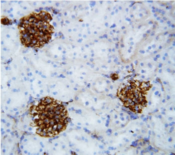 Anti-Collagen IV / COL4A2