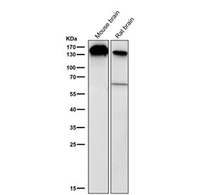 Anti-BCLAF1 / BCL2-associated transcription factor 1 / BTF, clone 32B81