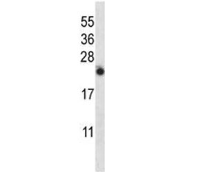 Anti-IL-13