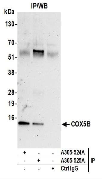 Anti-COX5B