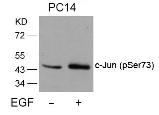 Anti-phospho-c-Jun (Ser73)