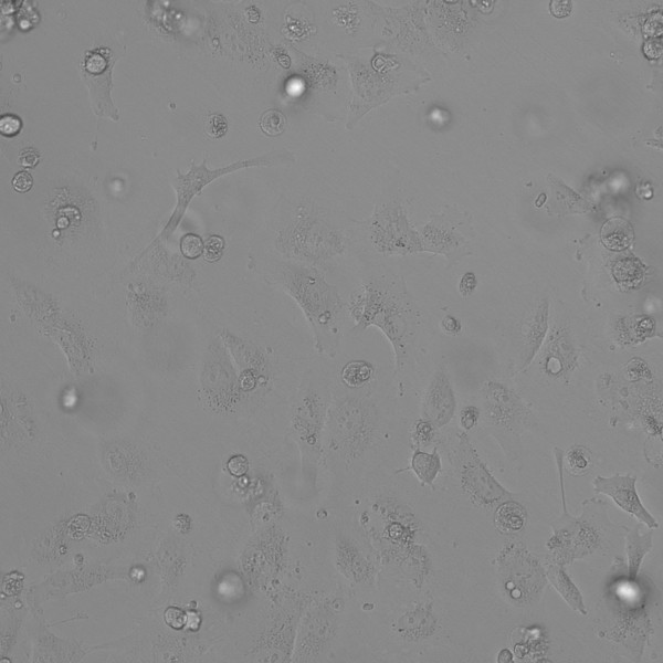 RCC-JW Cells