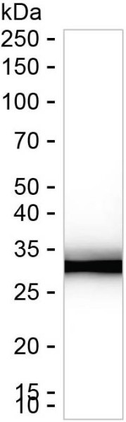 Anti-Sulfotransferase 2A1