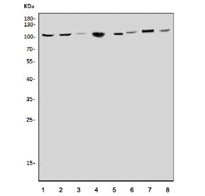 Anti-CLCN5 / CIC-5 antibody