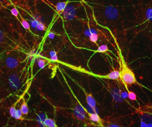 Anti-alpha Synuclein