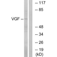 Anti-VGF