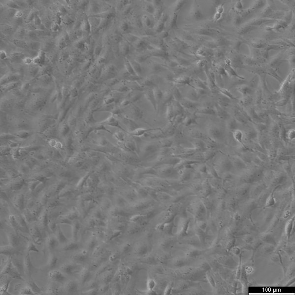 CTX TNA2 Cells