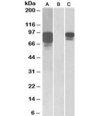 Anti-PCSK9