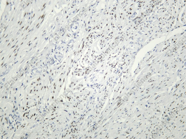 Anti-Recombinant Progesterone Receptor(PR), clone C312152