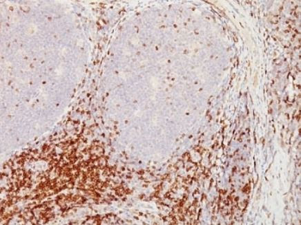 Anti-CD5, clone CD5/54/F6