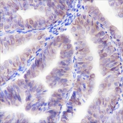 Anti-Recombinant ALOX15, clone A127