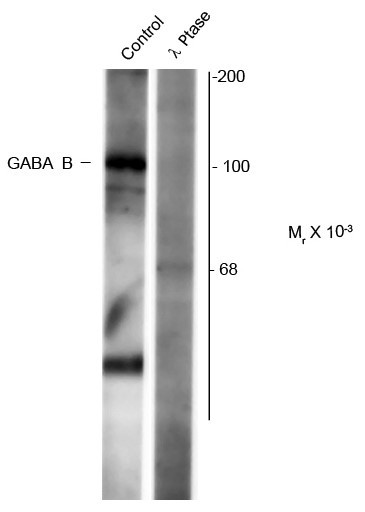 Anti-phospho-GABAB Receptor 1 (Ser923)