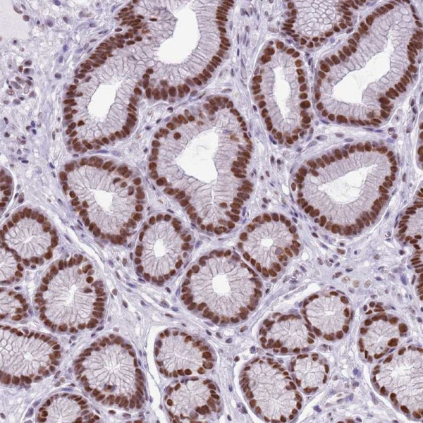 Anti-FAM104B
