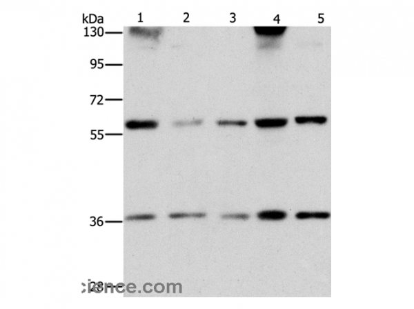 Anti-STK3/STK4