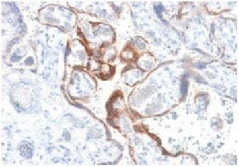 Anti-HCG-beta (Pregnancy &amp; Choriocarcinoma Marker) Recombinant Rabbit Monoclonal Antibody (clone:HCG