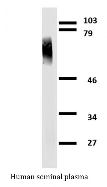 Anti-Apo J, clone Hs-3