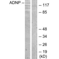 Anti-ADNP