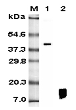 Anti-RELM-beta (human), clone HRB 149