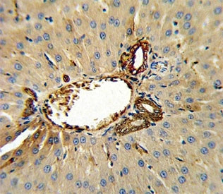 Anti-Annexin V