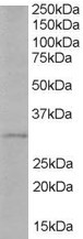 Anti-TIRAP / Mal (Isoform b), C-terminal