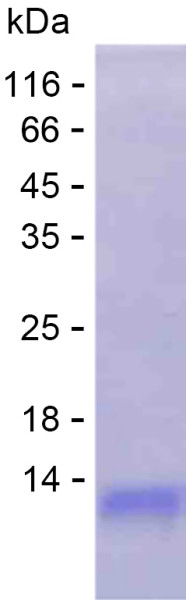 Recombinant Human USP17L23 Protein