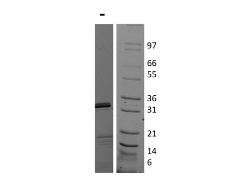 Interleukin-17E (IL-25)