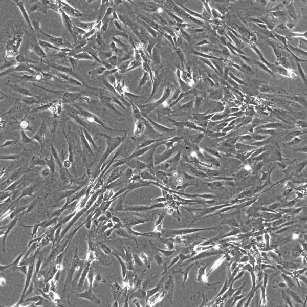 Wilms11 Cells