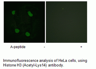 Anti-Histone H3 (Acetyl-Lys14)