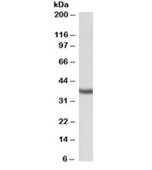 Anti-Clusterin