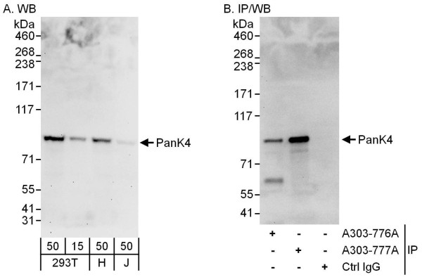 Anti-PanK4