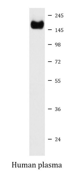 Anti-Complement factor H