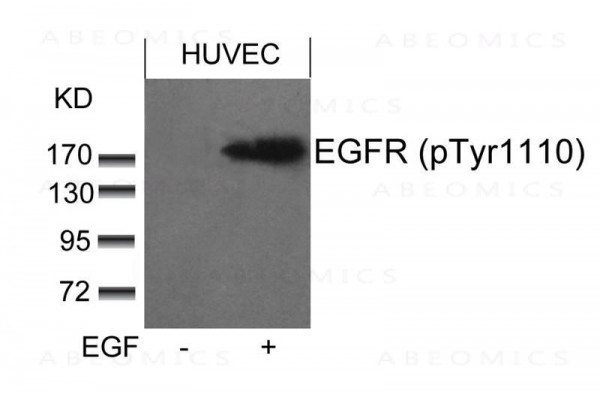 Anti-EGFR (phospho-Tyr1110)