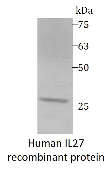 Human IL27 recombinant protein (His-tagged)