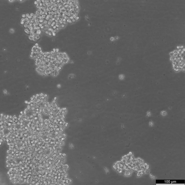 Y-79 Cells