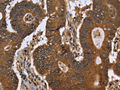 Anti-FGFRL1