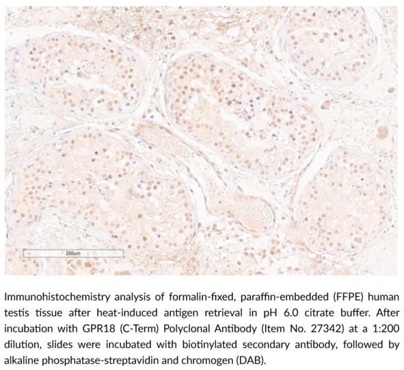 Anti-GPR18 (C-Term)