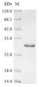 Charged multivesicular body protein 2b (CHMP2B), human, recombinant