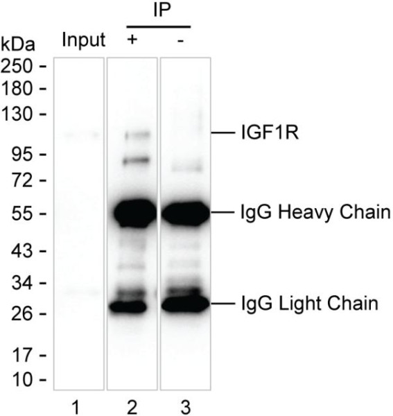 Anti-IGF1R