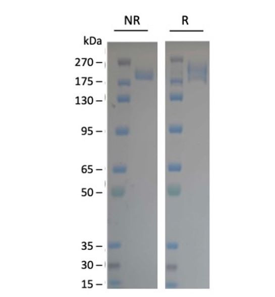Spike Trimer (S1+S2) (BQ.1.1, Omicron Variant), His-Tag (SARS-CoV-2) Recombinant