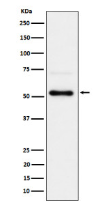 Anti-phospho-Chk1 (Ser280) / Checkpoint kinase 1, clone 31C46