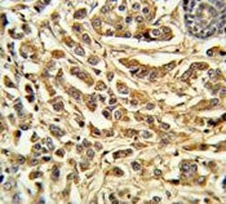 Anti-CYP21A2 / Steroid 21-hydroxylase