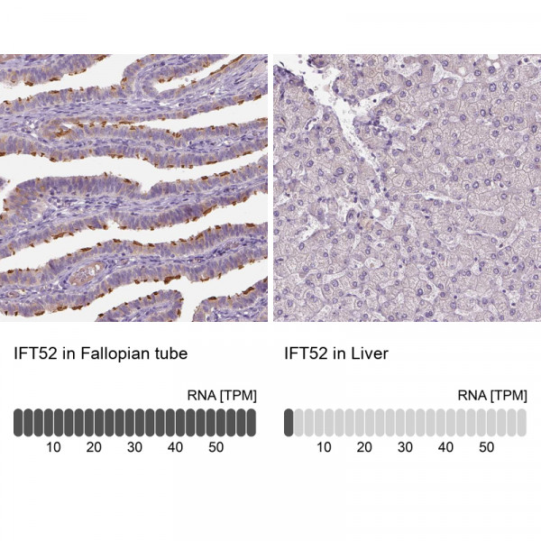 Anti-IFT52