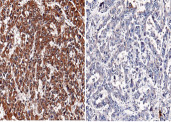Anti-NBL1/DAND1/DAN Monoclonal Antibody