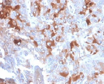 Anti-Clusterin / Apolipoprotein J (APO-J), clone CLU/4721