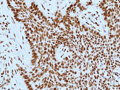 Anti-DNA-PKcs (human), Rabbit Monoclonal (RM505)