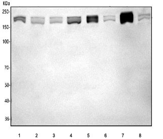 Anti-IFT172 / Intraflagellar transport protein 172