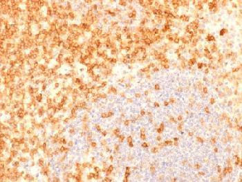 Anti-CD27 (Tumor Necrosis Factor Receptor Superfamily 7) Recombinant Mouse Monoclonal Antibody (clon