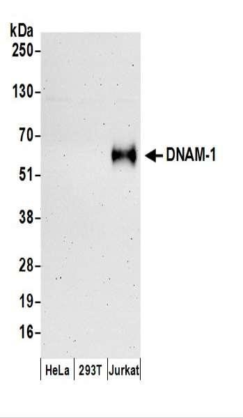 Anti-DNAM-1