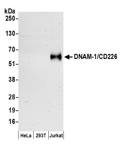 Anti-DNAM-1