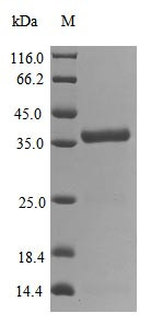3C-like proteinase (NSP5), Severe acute respiratory syndrome coronavirus 2, recombinant